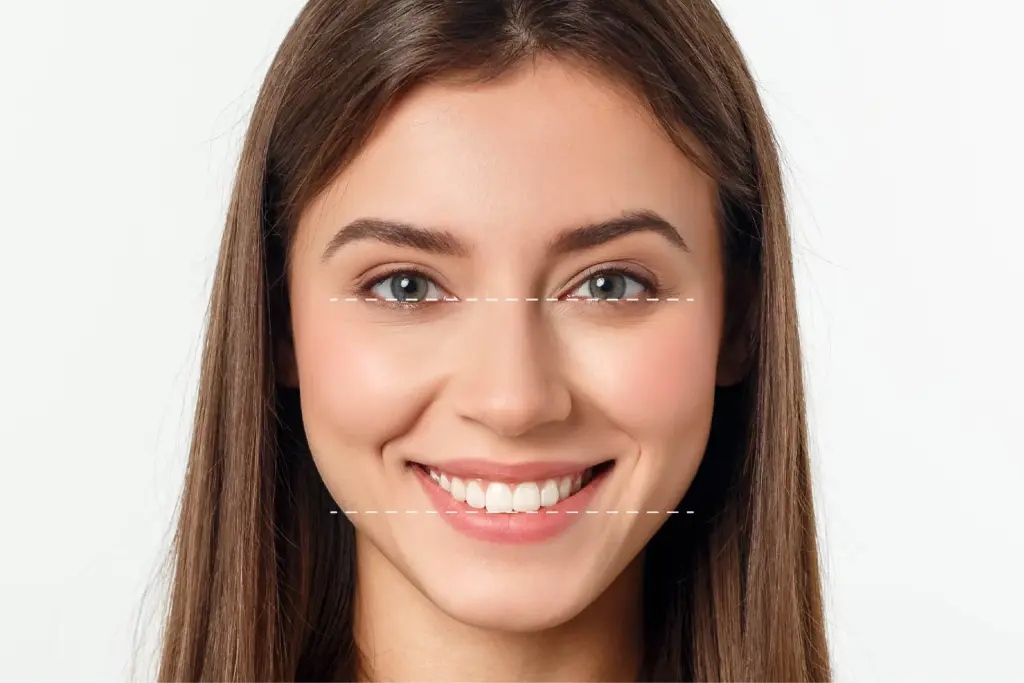 Parallel to pupils of the eyes scaled 1 Hollywood Smile