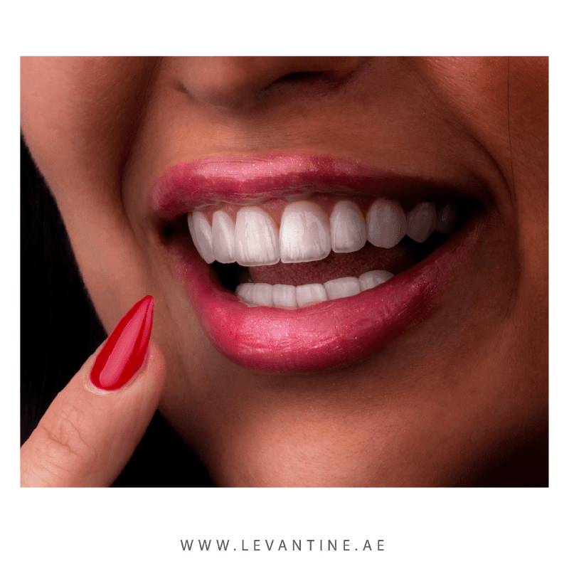 best dental veneers clinic in dubai Dental Veneers