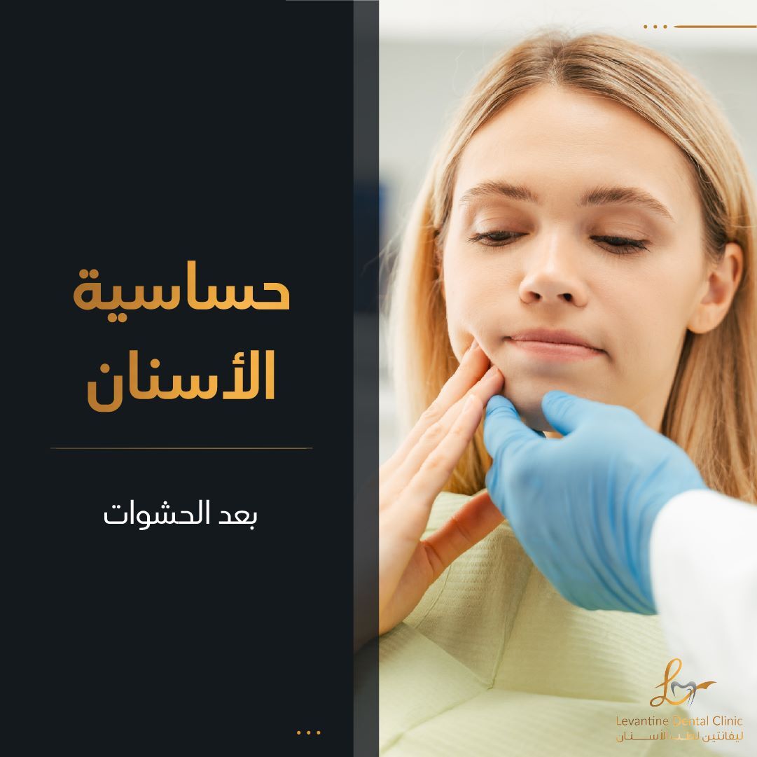 حساسية الأسنان بعد الحشوة