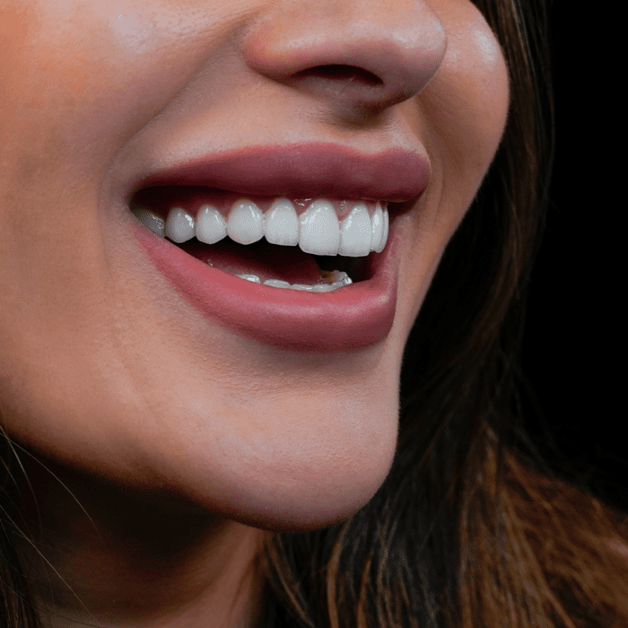 END NIVINE RIGHT happy patients