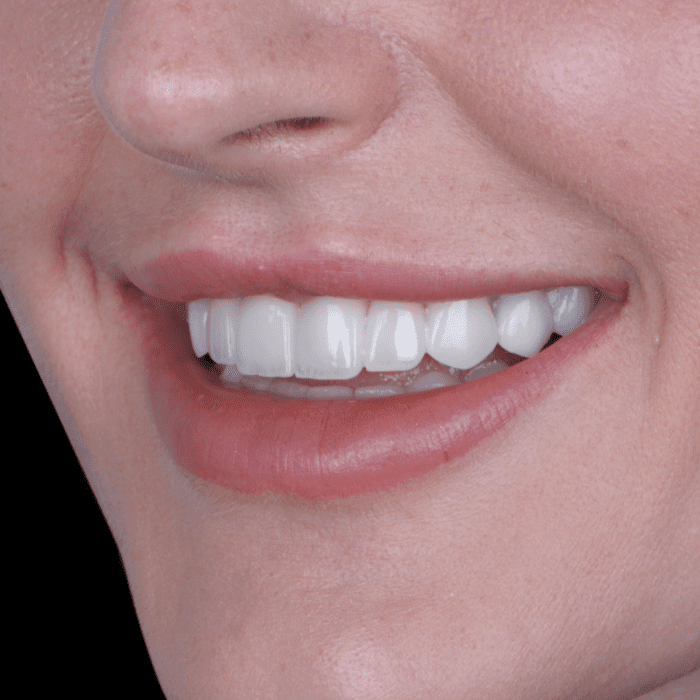 START WEBB LEFT happy patients