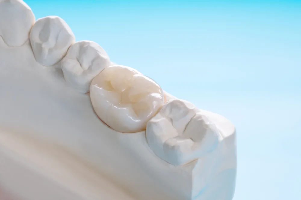 Zirconia Crowns Dental Crowns