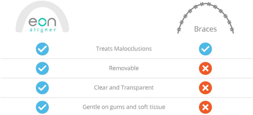 aligners vs braces Eon Aligner