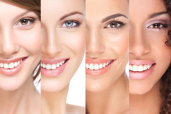 hollywood smile teeth straight Hollywood Smile