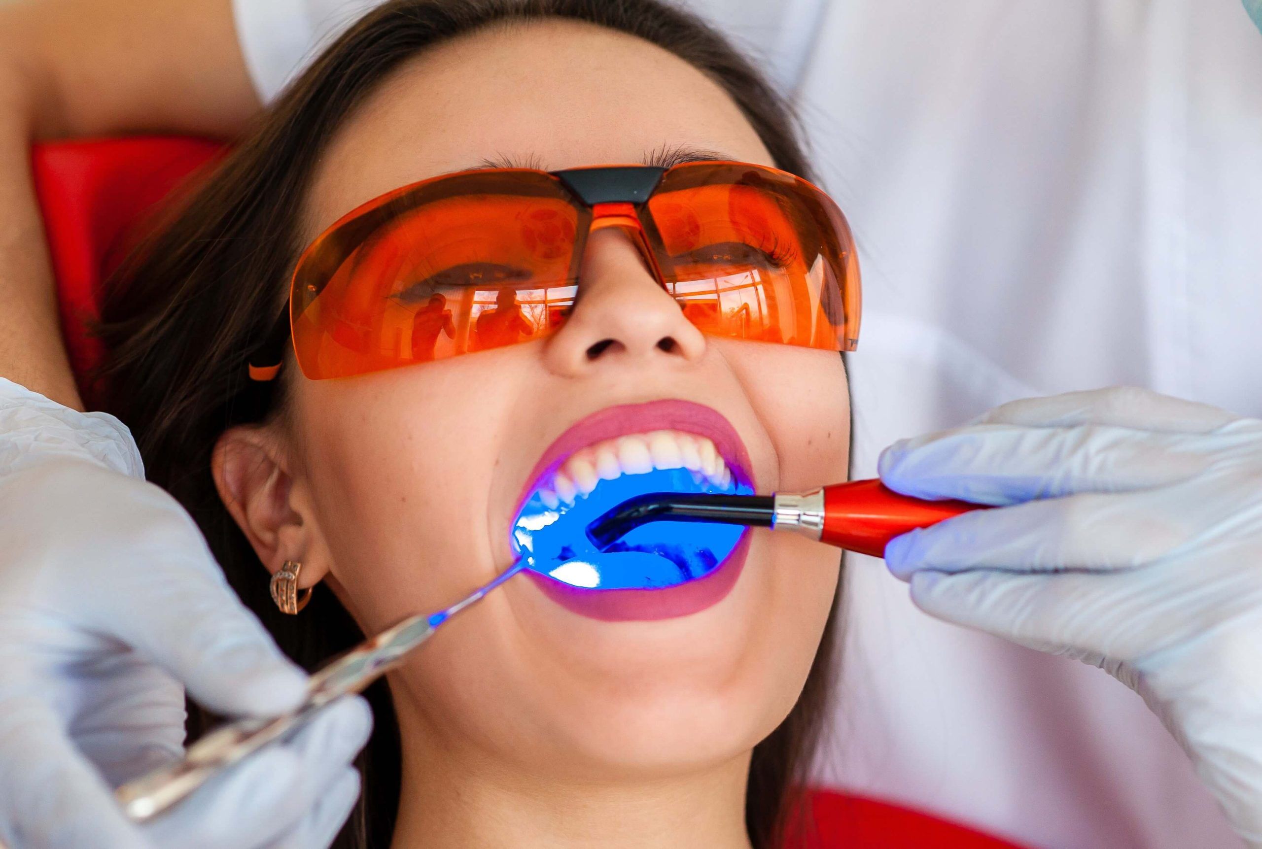 shutterstock 529876423 1 scaled Teeth Whitening