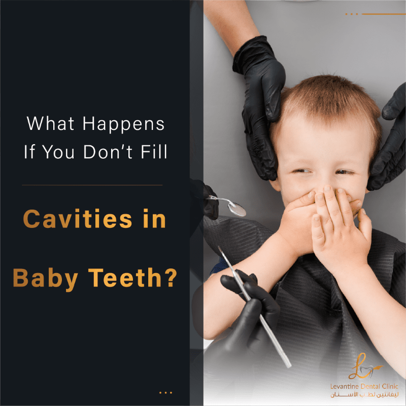 What Happens If You Don’t Fill Cavities in Baby Teeth