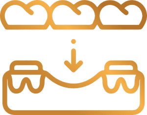 dental bridge Services