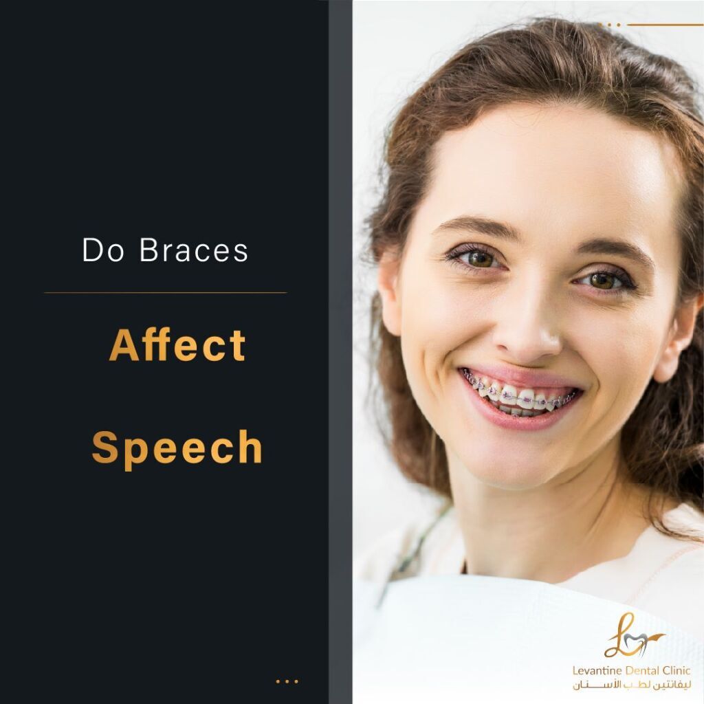 Do Braces Affect Speech