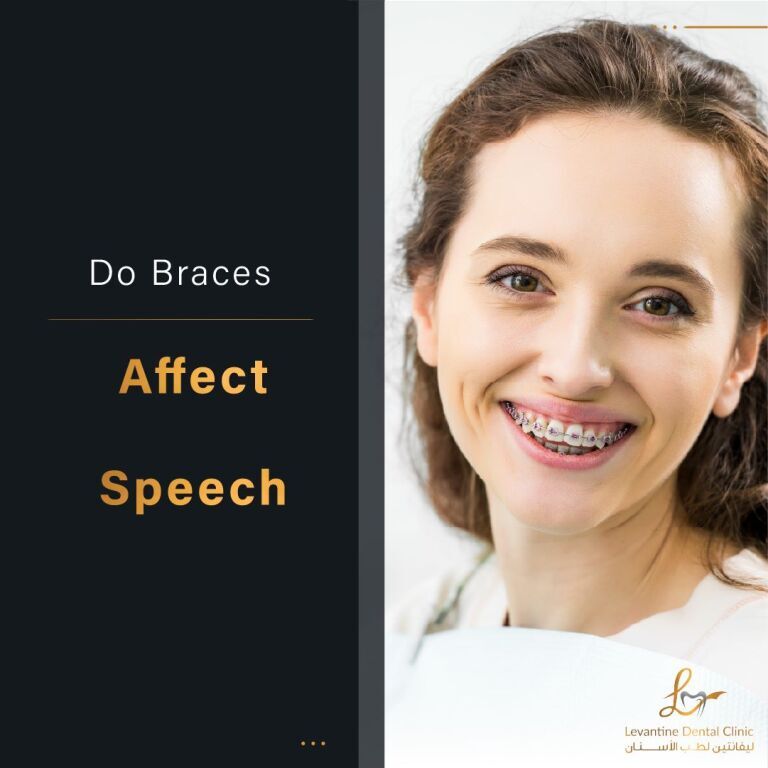 Do Braces Affect Speech