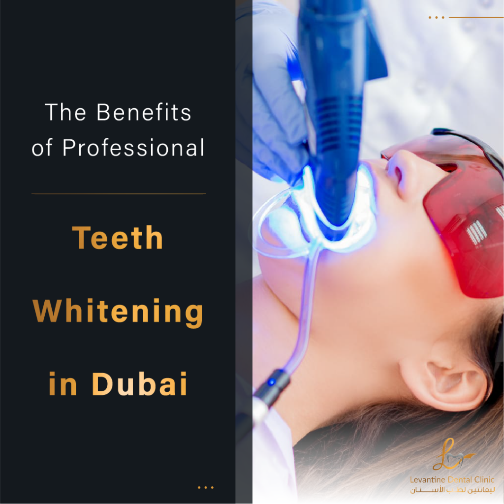 The Benefits of Professional Teeth Whitening in Dubai Enhance Your Confidence and Appearance