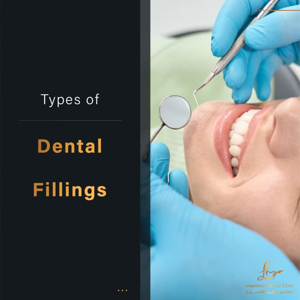 Types of Dental Fillings