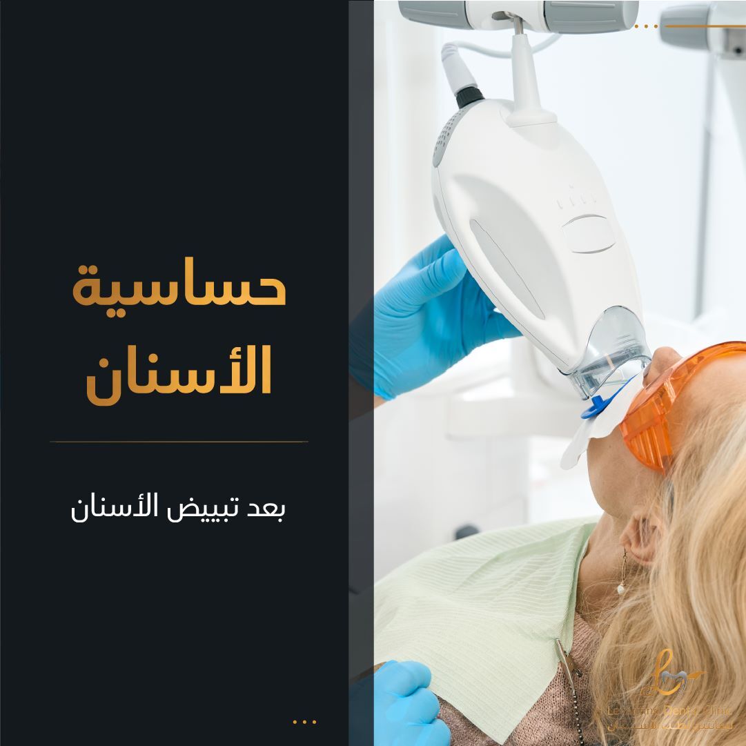 حساسة الأسنان بعد تبيض الأسنان