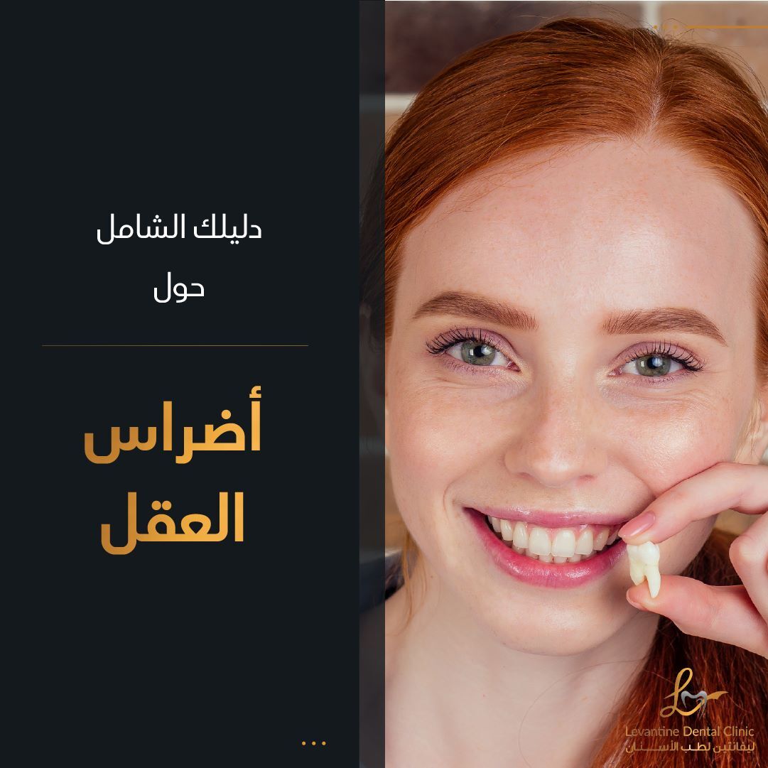 guide to wisdom tooth