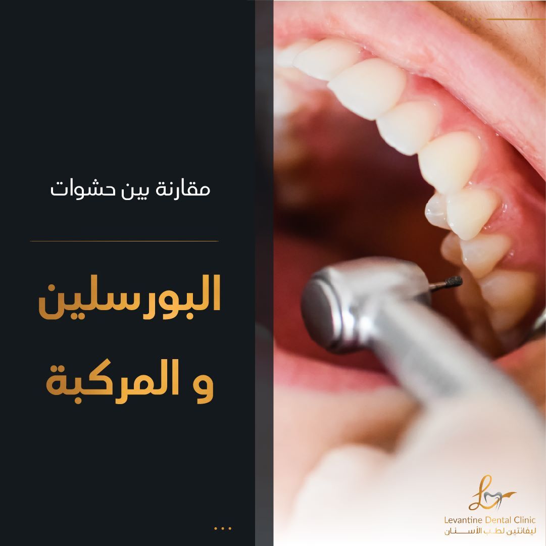 Porcelain Fillings vs Composite Fillings