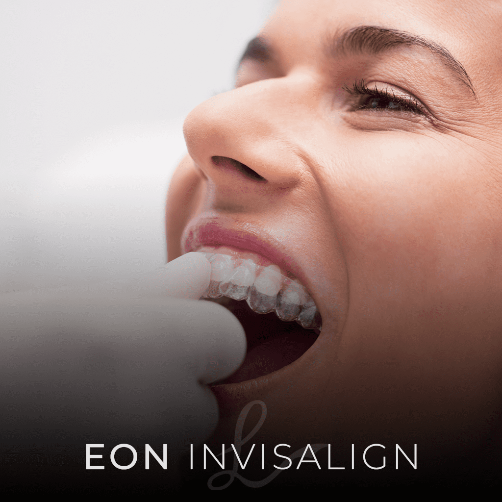 EON invisalign The Different Types of Orthodontic BRACES: Which Type is Right for You?