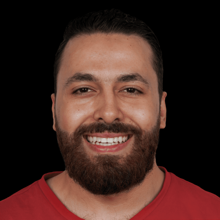 BILAL happy patients