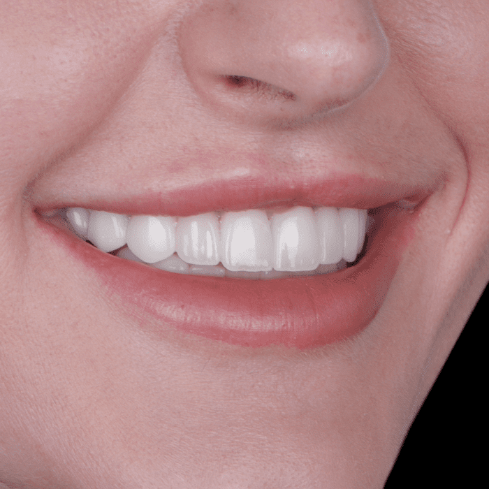 START WEBB RIGHT happy patients