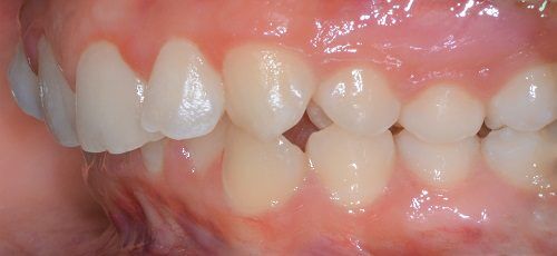 17-copy-n1