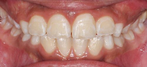 4after