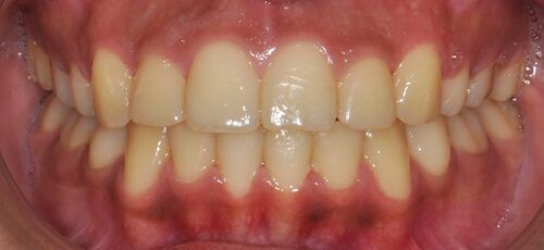 6after