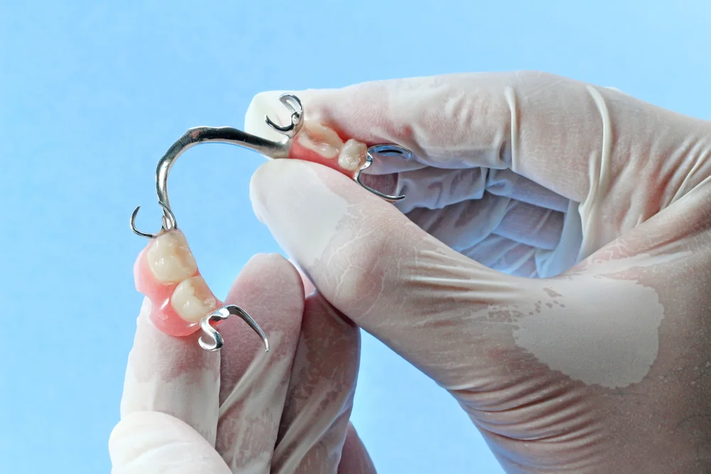 Removable Dentures 1 What are Removable Dentures Removable Dentures