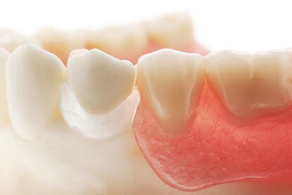 Removable Dentures 4 dentures acrylic material Removable Dentures