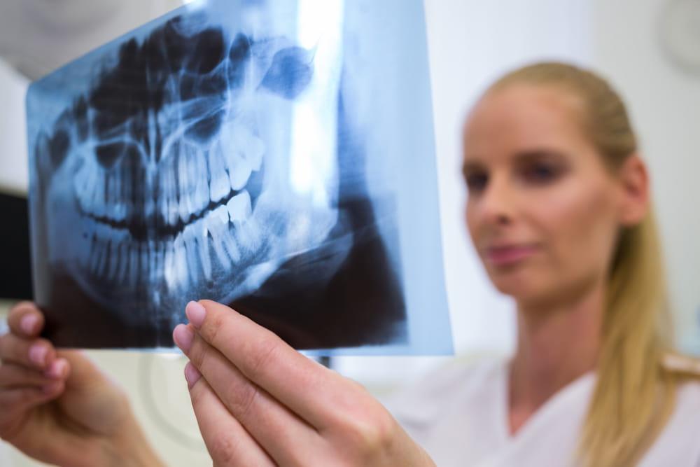 dental x-ray 1 أفضل جهاز أشعة أسنان في دبي