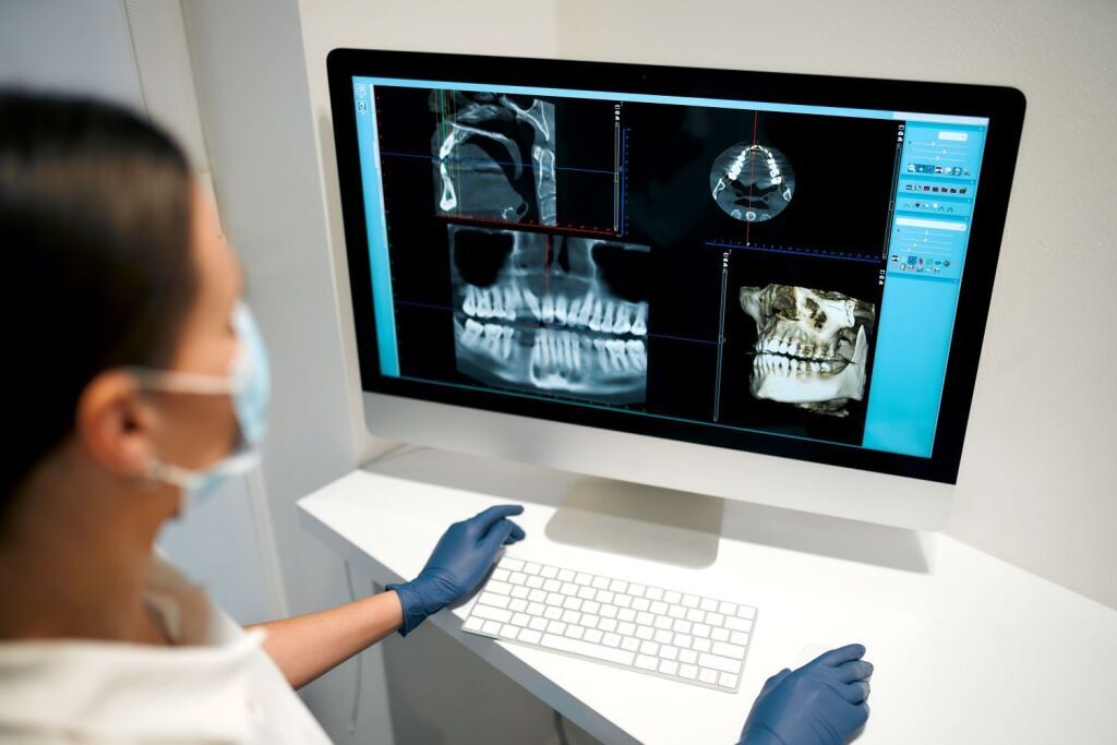 dental x-ray 11 اشعة cbct
