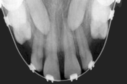 dental x-ray 10 CEPHALOMETRIC x ray