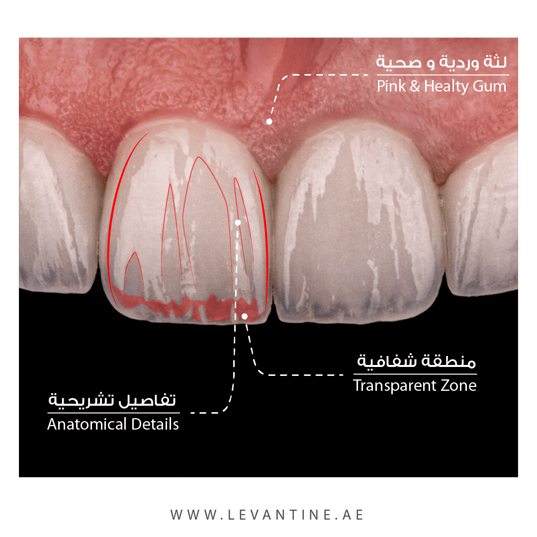 Dental Veneers 4 قشور البورسلين اكتشف الجمال الدائم لقشرة الأسنان