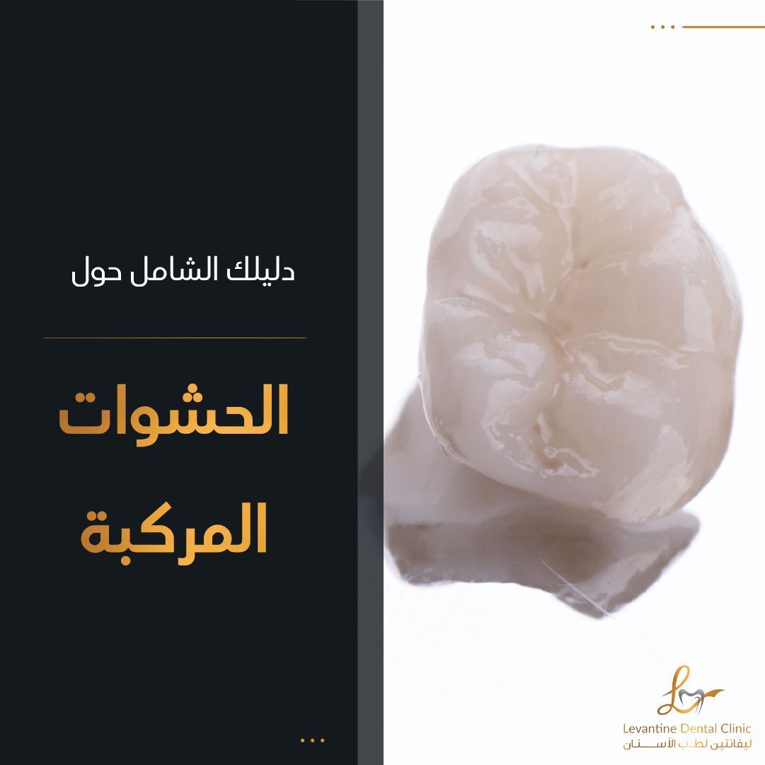 دليلك لحشوات الأسنان المركبة ( الكمبوزيت)