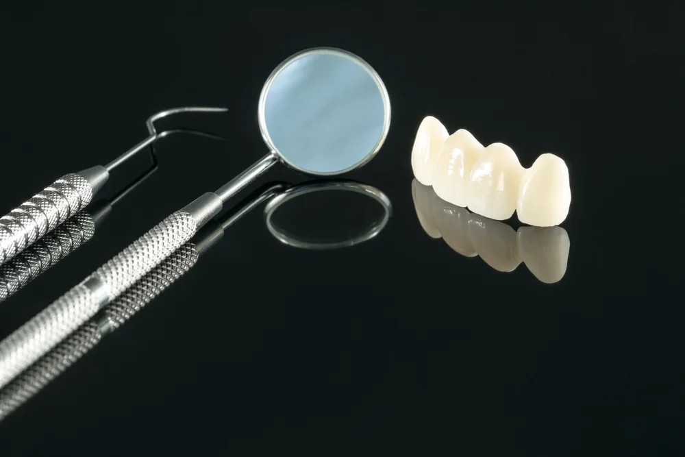 Traditional Bridges Dental Bridges