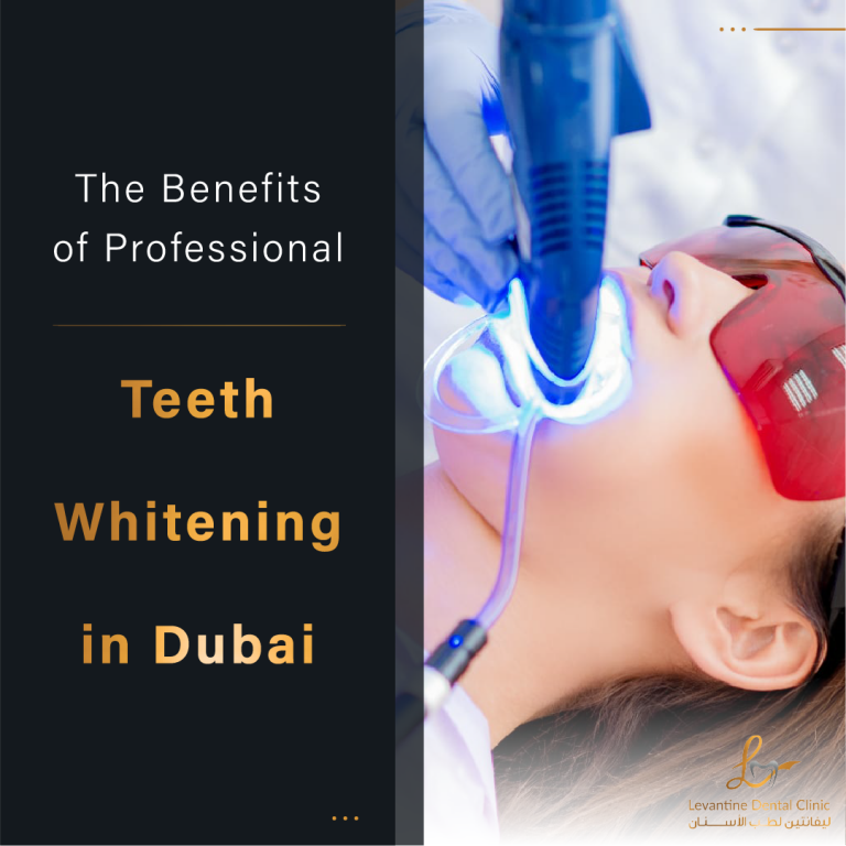 The Benefits of Professional Teeth Whitening in Dubai Enhance Your Confidence and Appearance