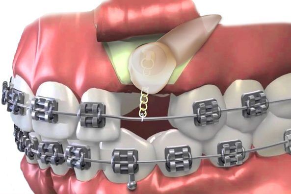 exposure oral Oral and Maxillofacial Surgery