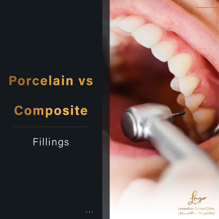 Porcelain Fillings vs Composite Fillings