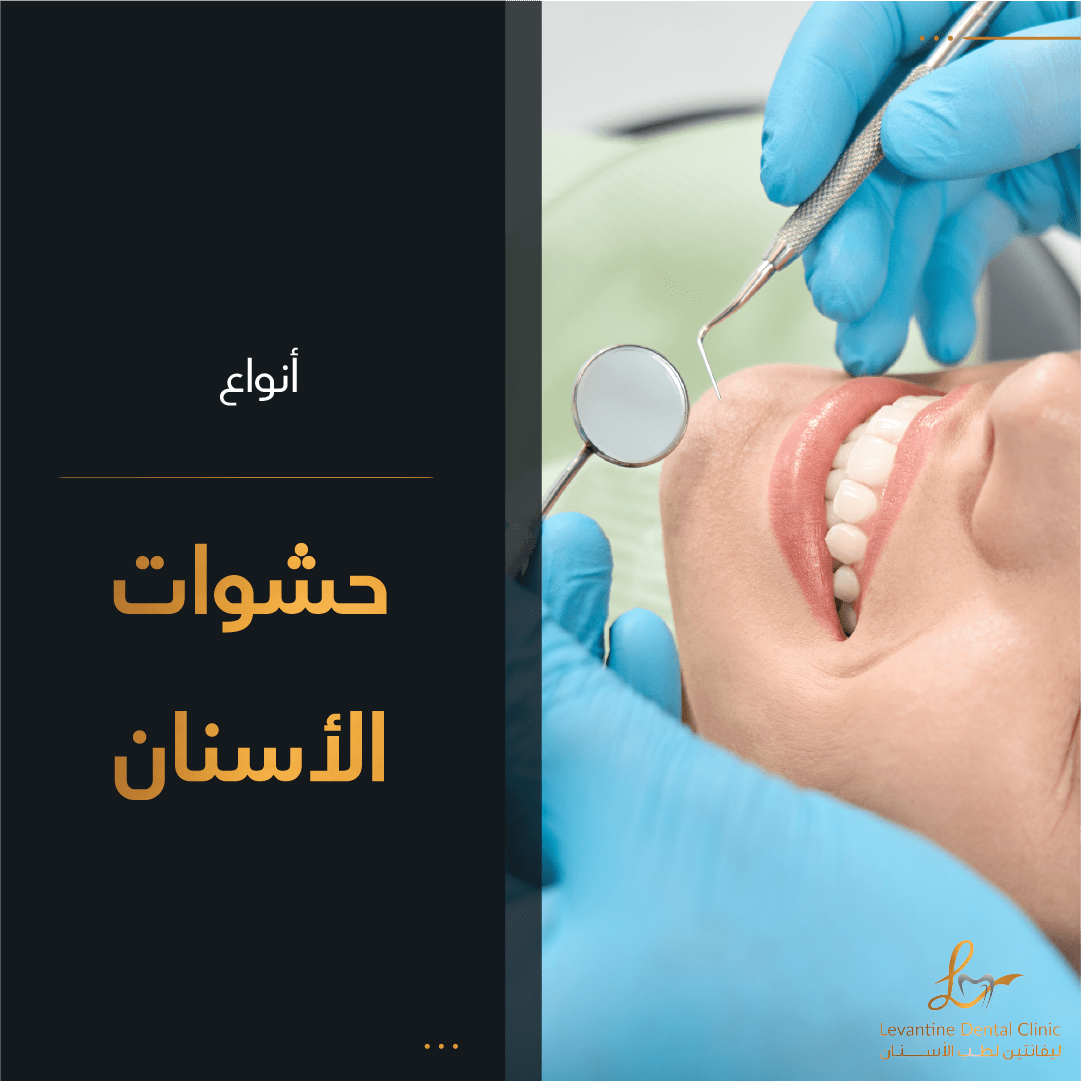 ما هي أنواع حشوات الاسنان